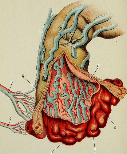 Image from page 497 of „Diseases of the rectum and anus: designed for students and practitioners of medicine“ (1910)